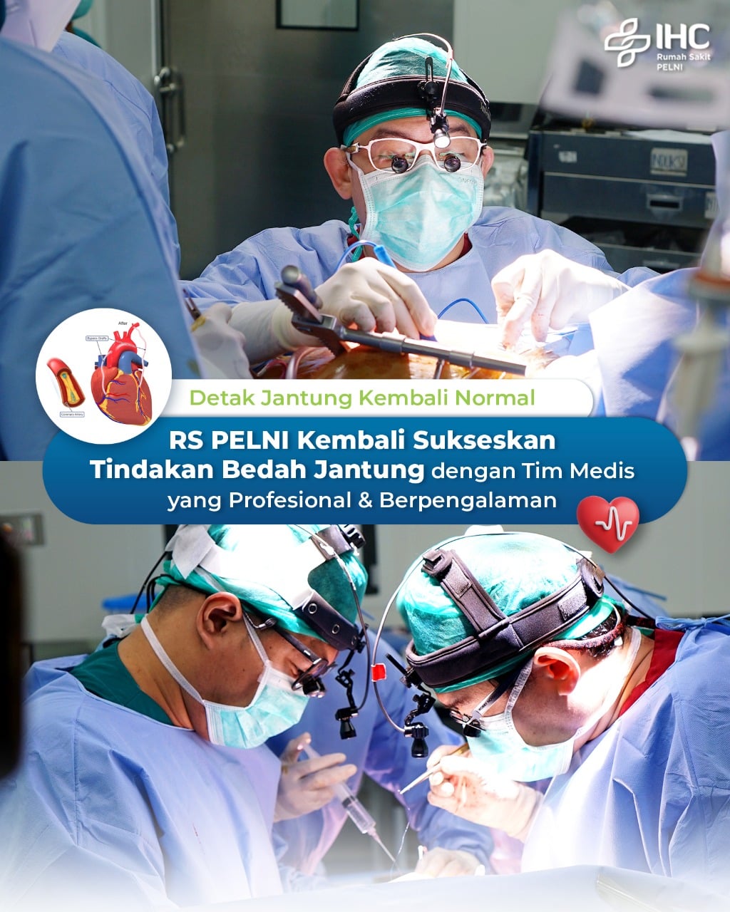 Bedah Jantung Prosedur Risiko Dan Pemulihan Rumah Sakit Pelni