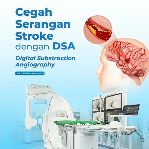 2024.09.09 Edukasi - Stroke DSA (4)