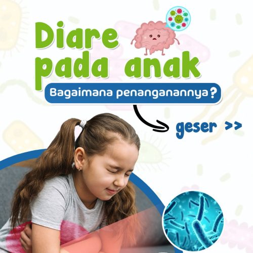2025.04.04 Edukasi - Diare Pada Anak #Sqr