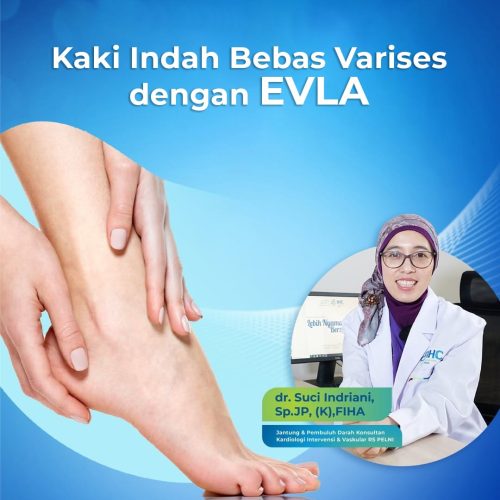 2025.05.20 Edukasi - Evla _Sqr