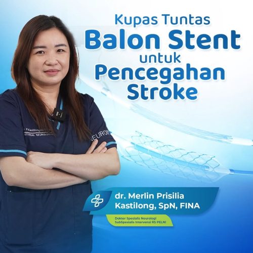 2025.09.24 Edukasi - Balon Stent Untuk Stroke #sqr