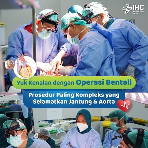 2025.10.06 Edukasi - Operasi Bentall