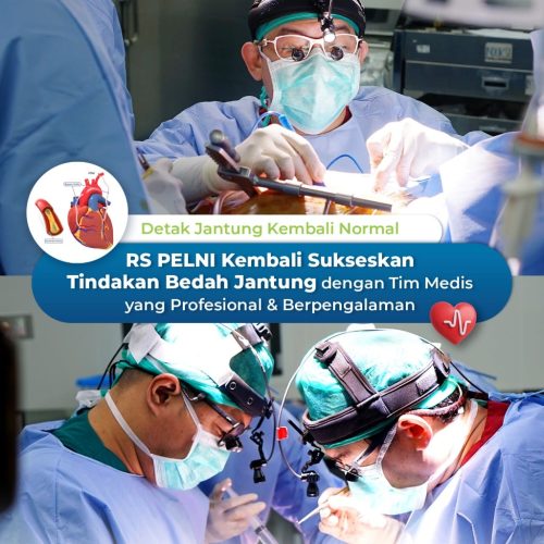 Bedah Jantung RS PELNI