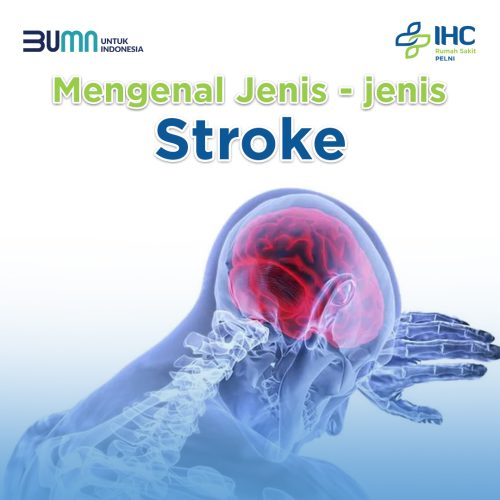 Jenis Stroke