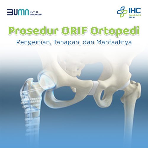 ORIF Orthopedi