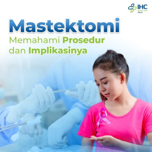 RS PELNI - Mastektomi Memahami Prosedur dan Implikasinya.