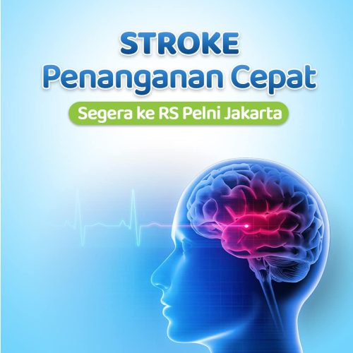 RS PELNI - Stroke Penanganan Cepat