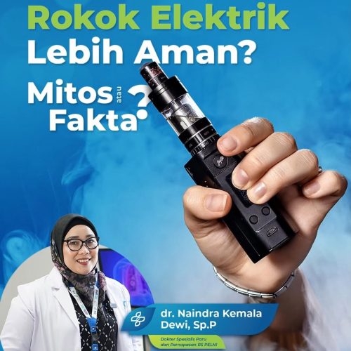 Rokok elektrik