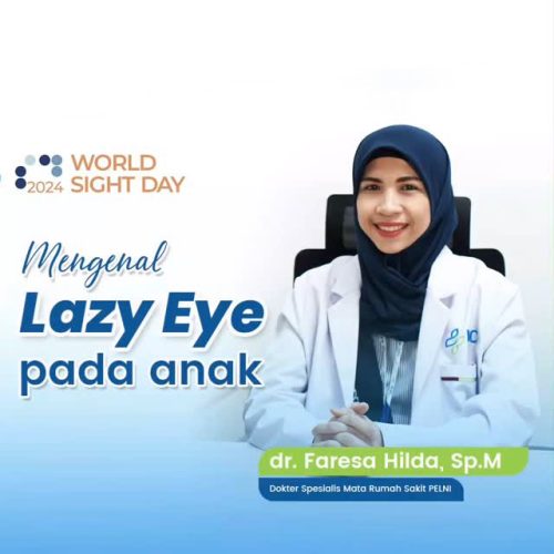 lazy eyes